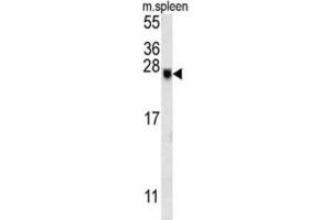 Western Blotting (WB) image for anti-EP300 Interacting Inhibitor of Differentiation 2 (EID2) antibody (ABIN3002400) (EID2 antibody)