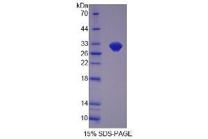 SDS-PAGE analysis of Mouse OVGP1 Protein. (OVGP1 Protein)