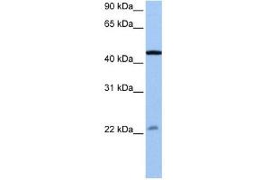 EWSR1 antibody used at 0. (EWSR1 antibody  (N-Term))