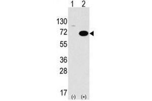 Image no. 1 for anti-serine threonine Kinase 39 (STK39) (C-Term) antibody (ABIN356942) (STK39 antibody  (C-Term))
