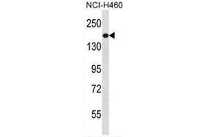 Western Blotting (WB) image for anti-Phosphatidylinositol-3,4,5-Trisphosphate-Dependent Rac Exchange Factor 1 (PREX1) (AA 1133-1163), (C-Term) antibody (ABIN954297)