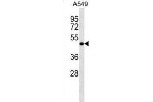 Western Blotting (WB) image for anti-Leucine Rich Repeat Containing 26 (LRRC26) antibody (ABIN2998660) (LRRC26 antibody)