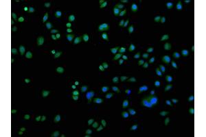 Immunofluorescence staining of Hela cells with ABIN7150833 at 1:200, counter-stained with DAPI. (DNM2 antibody  (AA 640-1119))