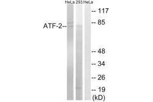 Western blot analysis of extracts from HeLa cells and 293 cells, using ATF-2 (Ab-472) antibody. (ATF2 antibody  (Ser472))
