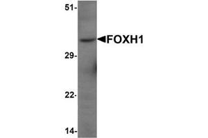 Western blot analysis of FOXH1 in human liver tissue lysate with FOXH1 Antibody  at 1 μg/mL (FOXH1 antibody  (N-Term))