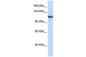 Western Blot showing PLA2G4B antibody used at a concentration of 1-2 ug/ml to detect its target protein. (PLA2G4B antibody  (N-Term))