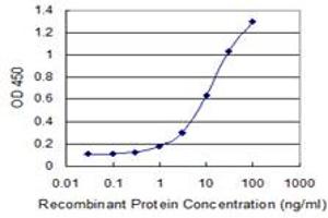 Detection limit for recombinant GST tagged RBM6 is 0. (RBM6 antibody  (AA 1024-1123))