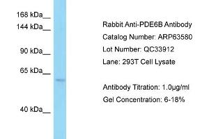 Western Blotting (WB) image for anti-phosphodiesterase 6B, CGMP-Specific, Rod, beta (PDE6B) (C-Term) antibody (ABIN2789553) (PDE6B antibody  (C-Term))