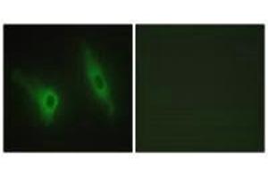 Immunofluorescence analysis of HeLa cells, using CKI-ε antibody. (CK1 epsilon antibody)