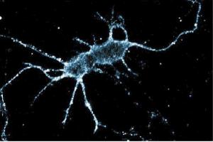 Immunofluoresence staining of rat neurons.