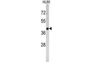 Western blot analysis of TROP2 antibody (Center) in HL60 cell line lysates (35ug/lane).