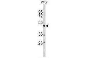 Western blot analysis of DEK Antibody (C-term) in WiDr cell line lysates (35µg/lane).