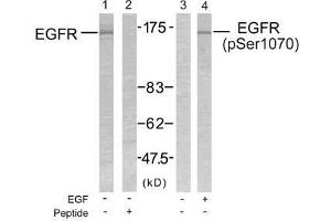 Western blot analysis of extract from SK-OV3 cells untreated or treated with EGF using EGFR (Ab-1070) antibody (E021073, Lane 1 and 2) and EGFR (phospho-Ser1070) antibody (E011080, Lane 3 and 4). (EGFR antibody)