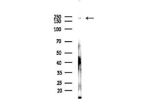 anti-C-Abl Oncogene 1, Non-Receptor tyrosine Kinase (ABL1) (pTyr226), (pTyr245) antibody