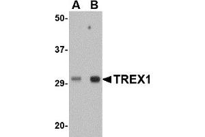 Western Blotting (WB) image for anti-three Prime Repair Exonuclease 1 (TREX1) (Middle Region) antibody (ABIN1031144) (TREX1 antibody  (Middle Region))