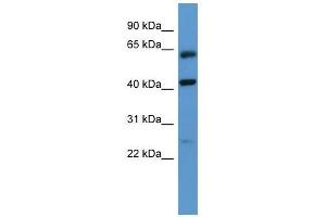 GPRC5B antibody used at 0. (GPRC5B antibody  (N-Term))