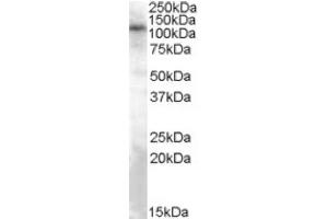 Image no. 1 for anti-Transient Receptor Potential Cation Channel, Subfamily C, Member 4 (TRPC4) (Internal Region) antibody (ABIN375258) (TRPC4 antibody  (Internal Region))