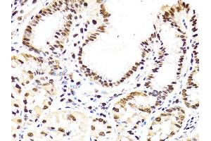 Immunohistochemistry of paraffin-embedded human stomach using PCNA antibody (ABIN1874056) at dilution of 1:100 (40x lens). (PCNA antibody)
