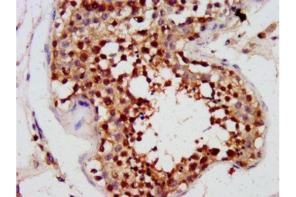 PHOX2A antibody  (AA 150-264)