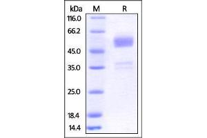 SDS-PAGE (SDS) image for B and T Lymphocyte Associated (BTLA) (AA 31-150) (Active) protein (Fc Tag) (ABIN2870806)