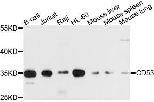 Western blot analysis of extracts of various cell lines, using CD53 antibody. (CD53 antibody)