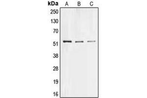 Western blot analysis of Collagen 26 alpha 1 expression in Hela (A), PC12 (B), H9C2 (C) whole cell lysates. (Collagen, Type XXVI, alpha 1 (COL26A1) (Center) antibody)