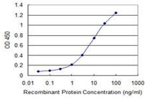 Detection limit for recombinant GST tagged UGT1A10 is 0. (UGT1A10 antibody  (AA 187-289))