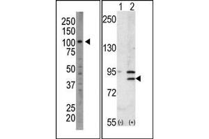 Image no. 1 for anti-Bromodomain Containing 2 (BRD2) (Middle Region) antibody (ABIN360494) (BRD2 antibody  (Middle Region))