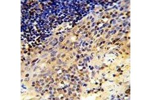 IHC analysis of FFPE human tonsil tissue stained with CD8A antibody (CD8 alpha antibody  (AA 59-88))