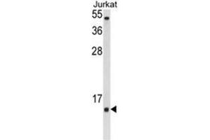 Western blot analysis of SOD1 Antibody (Center) in Jurkat cell line lysates (35ug/lane).