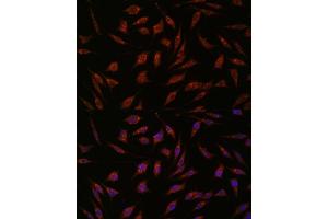 Immunofluorescence analysis of L929 cells using NXT2 antibody (ABIN6133260, ABIN6144977, ABIN6144978 and ABIN6217951) at dilution of 1:100. (NXT2 antibody  (AA 110-180))