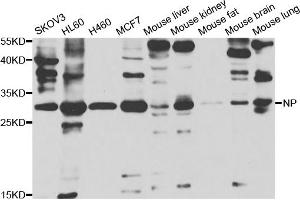 Western blot analysis of extracts of various cell lines, using PNP antibody (ABIN5973400) at 1/1000 dilution. (PNP antibody)