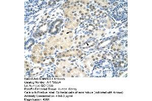 Human kidney (SMARCE1 antibody  (N-Term))