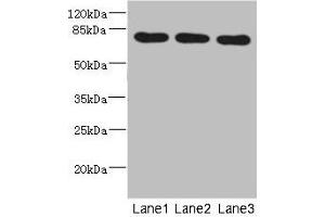 Western blot All lanes: BBS2 antibody at 5. (BBS2 antibody  (AA 1-96))