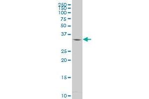 MBD3 polyclonal antibody (A01), Lot # 060509JCS1 Western Blot analysis of MBD3 expression in Y-79 . (MBD3 antibody  (AA 70-179))
