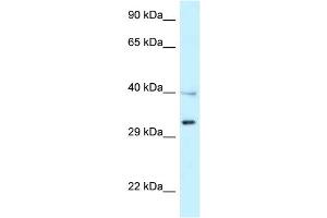 WB Suggested Anti-TNFRSF14 Antibody Titration: 1. (HVEM antibody  (Middle Region))