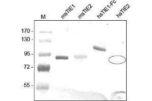 Western analysis of recombinant Human and Mouse sTIE-1 and sTIE-2 using a Polyclonal antibody directed against Mouse recombinant sTIE-1. (TIE1 antibody  (AA 22-748))