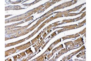 IHC analysis of VEGFB using anti-VEGFB antibody . (VEGFB antibody  (AA 22-207))