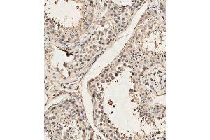 (ABIN657991 and ABIN2846937) staining Dyrk2 in human testis tissue sections by Immunohistochemistry (IHC-P - paraformaldehyde-fixed, paraffin-embedded sections). (DYRK2 antibody  (C-Term))