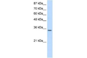 SNRPA antibody used at 0. (SNRPA1 antibody  (Middle Region))