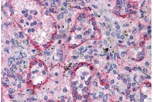 Human Spleen: Formalin-Fixed, Paraffin-Embedded (FFPE) (VTCN1 antibody)