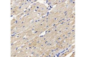 Immunohistochemistry analysis of paraffin-embedded rat heart using,DLAT (ABIN7073661) at dilution of 1: 1000 (CYB561 antibody)