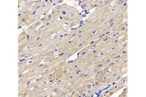 Immunohistochemistry analysis of paraffin-embedded rat heart using,DLAT (ABIN7073661) at dilution of 1: 1000