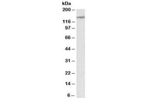 Western blot testing of human cerebellum lysate with LMTK2 antibody at 2ug/ml. (LMTK2 antibody)