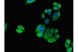 Immunofluorescent analysis of HepG2 cells using ABIN7142516 at dilution of 1:100 and Alexa Fluor 488-congugated AffiniPure Goat Anti-Rabbit IgG(H+L) (RPS21 antibody  (AA 1-81))