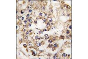 Image no. 1 for anti-Pancreatic and Duodenal Homeobox 1 (PDX1) (N-Term) antibody (ABIN360026)