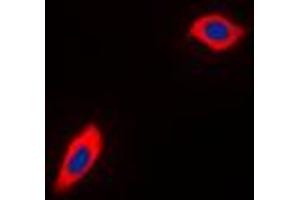 Immunofluorescent analysis of PEX11B staining in THP1 cells. (PEX11B antibody  (Center))