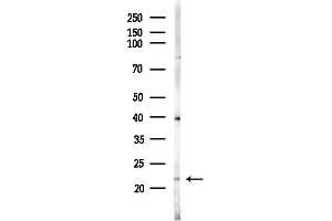 Western blot analysis of lysates from Raji cells(heat-shock,45 min treatment), using R Antibody at 1/1000 dilution.