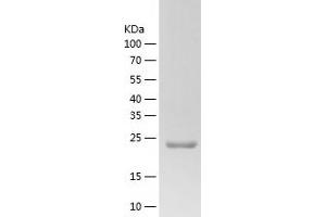 Western Blotting (WB) image for Endothelin 3 (EDN3) (AA 26-238) protein (His tag) (ABIN7122782) (Endothelin 3 Protein (EDN3) (AA 26-238) (His tag))