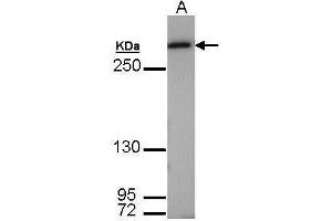 Western Blotting (WB) image for anti-Fatty Acid Synthase (FASN) (N-Term) antibody (ABIN2856708)